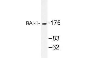 Image no. 1 for anti-Brain-Specific Angiogenesis Inhibitor 1 (BAI1) antibody (ABIN317742) (BAI1 Antikörper)