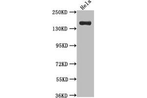 Western Blot Positive WB detected in: Hela whole cell lysate All lanes: Xanthine Oxidase antibody at 1:1000 Secondary Goat polyclonal to rabbit IgG at 1/50000 dilution Predicted band size: 147 kDa Observed band size: 147 kDa (Rekombinanter XDH Antikörper)
