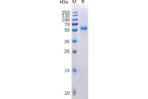 Human  LAG3 Protein, His Tag on SDS-PAGE under reducing condition.