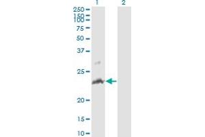 Western Blot analysis of TNFSF14 expression in transfected 293T cell line by TNFSF14 monoclonal antibody (M01A), clone 4E3. (TNFSF14 Antikörper  (AA 61-170))