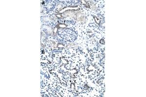 Immunohistochemical staining (Formalin-fixed paraffin-embedded sections) of human kidney (A) and human lung (B) with EVX1 polyclonal antibody  at 4-8 ug/mL working concentration. (EVX1 Antikörper  (N-Term))
