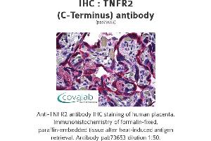 Image no. 1 for anti-Tumor Necrosis Factor Receptor Superfamily, Member 1B (TNFRSF1B) (C-Term) antibody (ABIN1740187) (TNFRSF1B Antikörper  (C-Term))