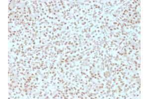 Formalin-fixed, paraffin-embedded human Pancreas stained with AKT1 Mouse Monoclonal Antibody (AKT1/2491).