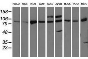 Western blot analysis of extracts (35 µg) from 9 different cell lines by using anti-PRKD2 monoclonal antibody.