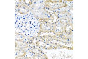 Immunohistochemistry of paraffin-embedded rat kidney using OGFR antibody at dilution of 1:100 (x40 lens). (OGFR Antikörper)