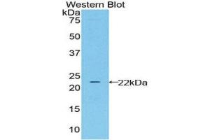 Western Blotting (WB) image for anti-Lipocalin 2 (LCN2) (AA 21-198) antibody (ABIN1078407)