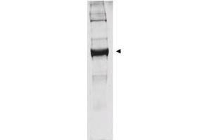 Western blot analysis is shown using  anti-bovine glutamate dehydrogenase antibody to detect the enzyme from bovine liver preparations. (GLUD1 Antikörper)