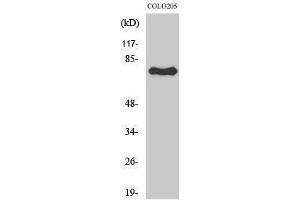 Western Blotting (WB) image for anti-Activating Transcription Factor 6 beta (ATF6B) (Internal Region) antibody (ABIN3183420) (ATF6B Antikörper  (Internal Region))