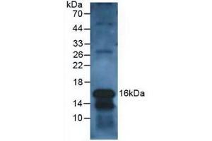 Detection of CLC in Human Leukocyte Cells using Polyclonal Antibody to Charcot Leyden Crystal Protein (CLC) (Galectin 10 Antikörper  (AA 2-142))
