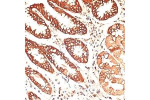 Immunohistochemistry (IHC) image for anti-Keratin 13 (KRT13) (AA 269-458) antibody (ABIN7268090)