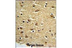 Immunohistochemistry (Paraffin-embedded Sections) (IHC (p)) image for anti-PTK2 Protein tyrosine Kinase 2 (PTK2) (AA 821-848), (C-Term) antibody (ABIN652554)