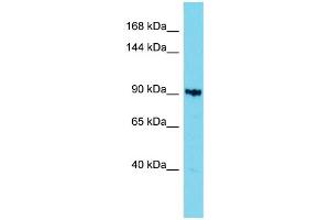 Host: Rabbit Target Name: KIAA1614 Sample Type: 721_B Whole Cell lysates Antibody Dilution: 1. (KIAA1614 Antikörper  (C-Term))