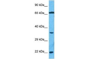 Host:  Rabbit  Target Name:  PEBB  Sample Type:  MCF7 Whole Cell lysates  Antibody Dilution:  1.