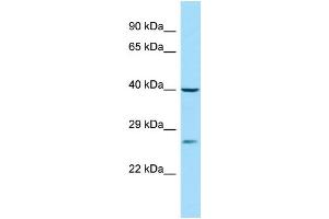 WB Suggested Anti-PISD Antibody Titration: 1. (PISD Antikörper  (C-Term))