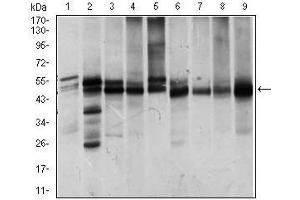 Western blot analysis using ILK mouse mAb against Jurkat (1), NIH3T3 (2), HeLa (3), PC-12 (4), C6 (5), COS7 (6), Raji (7), K562 (8) and MCF-7 (9) cell lysate. (ILK Antikörper  (AA 97-244))