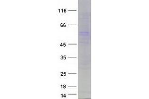 Validation with Western Blot (PRAME Protein (Transcript Variant 4) (Myc-DYKDDDDK Tag))