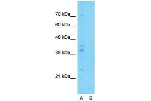 Host:  Rabbit  Target Name:  G6PC  Sample Type:  Human Fetal Lung  Lane A:  Primary Antibody  Lane B:  Primary Antibody + Blocking Peptide  Primary Antibody Concentration:  1ug/ml  Peptide Concentration:  5ug/ml  Lysate Quantity:  25ug/lane/lane  Gel Concentration:  0. (G6PC Antikörper  (N-Term))