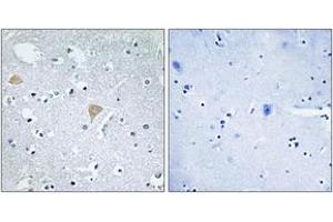 Immunohistochemistry analysis of paraffin-embedded human brain tissue, using CTRO Antibody. (CIT Antikörper  (AA 1011-1060))