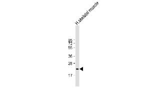 Western Blotting (WB) image for anti-Fibronectin Type III Domain Containing 5 (FNDC5) (AA 12-152) antibody (ABIN6243784)