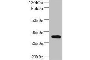Western blot All lanes: CCDC127 antibody at 6 μg/mL + Mouse kidney tissue Secondary Goat polyclonal to rabbit IgG at 1/10000 dilution Predicted band size: 31 kDa Observed band size: 31 kDa (CCDC127 Antikörper  (AA 1-260))