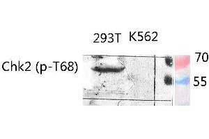 Western Blot (WB) analysis of specific lysis using Phospho-Chk2 (T68) Polyclonal Antibody. (CHEK2 Antikörper  (pThr68))