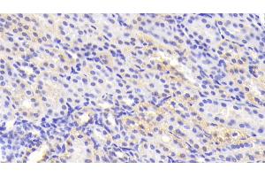 Detection of TNKS2 in Human Kidney Tissue using Polyclonal Antibody to Tankyrase 2 (TNKS2) (TNKS2 Antikörper)