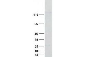Western Blotting (WB) image for Synaptopodin 2-Like (SYNPO2L) (Transcript Variant 1) protein (Myc-DYKDDDDK Tag) (ABIN2733061)