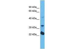 Western Blotting (WB) image for anti-Olfactory Receptor, Family 5, Subfamily D, Member 14 (OR5D14) (C-Term) antibody (ABIN2791753) (OR5D14 Antikörper  (C-Term))
