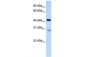 Image no. 1 for anti-GRAM Domain Containing 2 (GRAMD2) (AA 144-193) antibody (ABIN6740892) (GRAMD2 Antikörper  (AA 144-193))