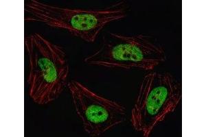 Fluorescent image of HeLa cell stained with PITX2 antibody. (PITX2 Antikörper  (AA 122-151))