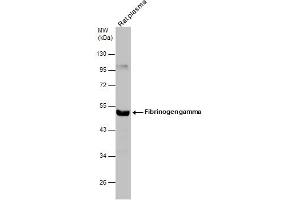 WB Image Rat tissue extract (50 μg) was separated by 10% SDS-PAGE, and the membrane was blotted with Fibrinogen gamma antibody , diluted at 1:500.
