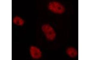 ABIN6275636 staining HepG2 by IF/ICC. (TCF4/12 Antikörper)