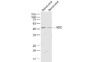 Lane 1: Mouse Spinal cord lysates Lane 2: Rat Spinal cord lysates probed with NSE Polyclonal Antibody, Unconjugated  at 1:300 dilution and 4˚C overnight incubation. (ENO2/NSE Antikörper  (AA 201-300))