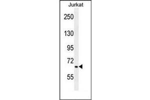 Western blot analysis of F11 Antibody (Center) in Jurkat cell line lysates (35ug/lane).