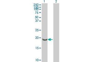 Western Blot analysis of SNCB expression in transfected 293T cell line by SNCB MaxPab polyclonal antibody. (beta Synuclein Antikörper  (AA 1-134))