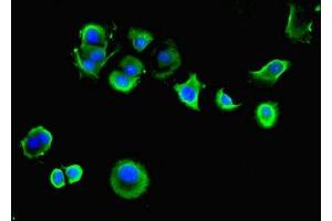 Immunofluorescent analysis of MCF-7 cells using ABIN7143931 at dilution of 1:100 and Alexa Fluor 488-congugated AffiniPure Goat Anti-Rabbit IgG(H+L) (SGCA Antikörper  (AA 24-290))