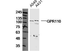 Human A549 and A431 cell lysates probed with GPR110 Polyclonal Antibody, unconjugated  at 1:300 overnight at 4°C followed by a conjugated secondary antibody at 1:10000 for 90 minutes at 37°C. (G Protein-Coupled Receptor 110 Antikörper  (AA 51-150))