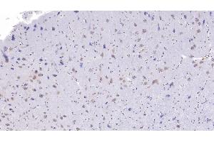 Detection of CC16 in Human Cerebrum Tissue using Monoclonal Antibody to Clara Cell Protein 16 (CC16) (SCGB1A1 Antikörper  (AA 23-91))