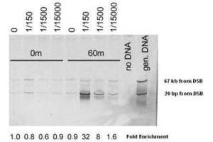 Chromatin Immunoprecipitation (ChIP) using  Affinity Purified Mre11 (S.
