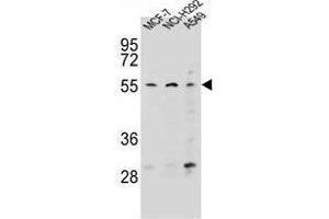 ZNF117 Antibody (N-term) western blot analysis in MCF-7,NCI-H292,A549 cell line lysates (35 µg/lane).