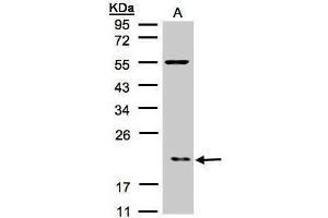 WB Image Sample(30 μg of whole cell lysate) A:Raji , 12% SDS PAGE antibody diluted at 1:500 (ARPC3 Antikörper)