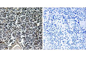 Peptide - +Immunohistochemistry analysis of paraffin-embedded human thymus gland tissue using ABCB7 antibody. (ABCB7 Antikörper)
