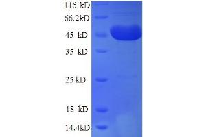 SDS-PAGE (SDS) image for Tryptophan 2,3-Dioxygenase (TDO2) (AA 1-406), (full length) protein (His tag) (ABIN5713880)