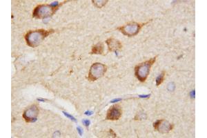 Immunohistochemical staining of paraffin embedded rat brain tissue section with PPID polyclonal antibody . (PPID Antikörper  (C-Term))