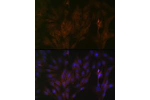 Immunofluorescence analysis of C6 cells using 15-PGDH/HPGD Rabbit mAb (ABIN7267807) at dilution of 1:100 (40x lens). (HPGD Antikörper)