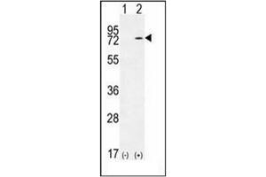 Western blot analysis of KARS (arrow) using KARS Antibody (N-term) Cat.