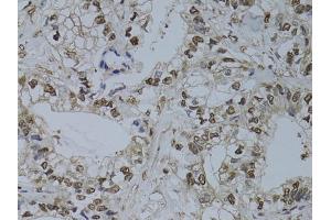 Immunohistochemistry (IHC) image for anti-HUS1 Checkpoint Homolog (S. Pombe) (HUS1) (AA 1-280) antibody (ABIN6142084)