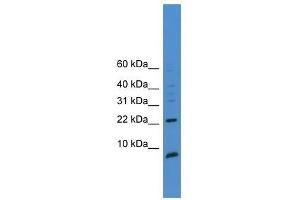 Western Blot showing PSCA antibody used at a concentration of 1-2 ug/ml to detect its target protein. (PSCA Antikörper  (C-Term))