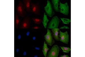 Phospho-YAP (Ser941) Antibody staining A549 cells(4h of LPS treatment) by IF/ICC. (YAP1 Antikörper  (pSer941))