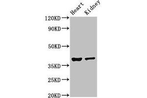 Western Blot Positive WB detected in: Mouse heart tissue, Mouse kidney tissue All lanes: NEUROD1 antibody at 4 μg/mL Secondary Goat polyclonal to rabbit IgG at 1/50000 dilution Predicted band size: 40 kDa Observed band size: 40 kDa (NEUROD1 Antikörper  (AA 154-356))